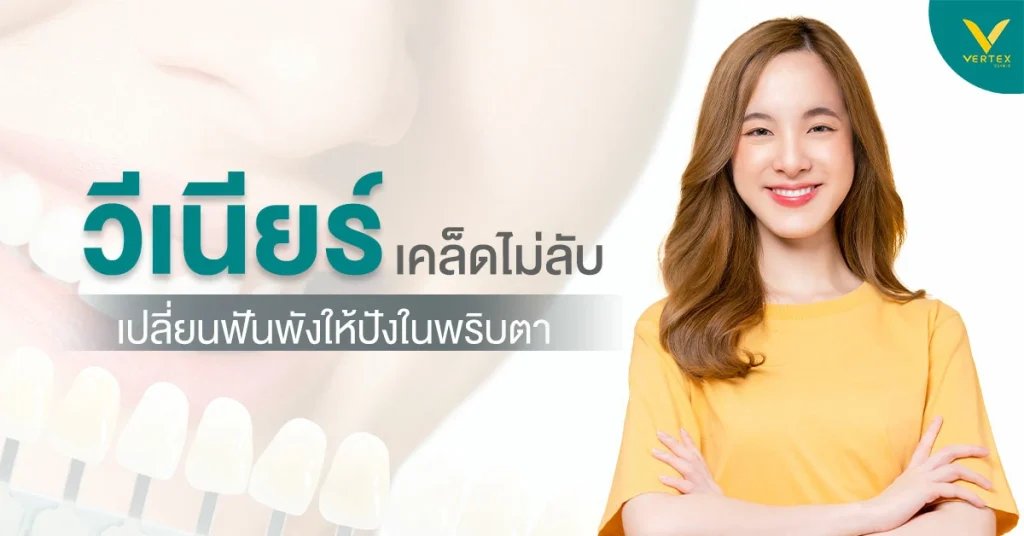 วีเนียร์คืออะไร