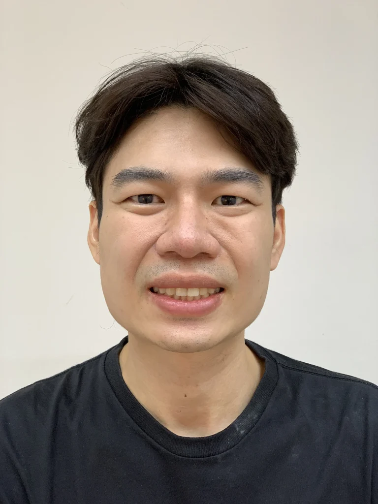 ก่อนผ่าตัดกราม มุมตรงและหันข้าง 