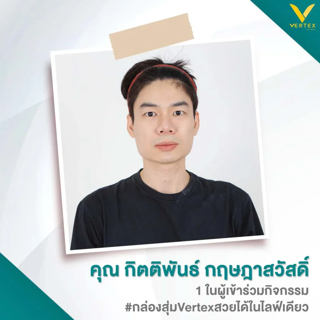 ผู้โชคดีโปรกล่องสุ่ม สวย 1