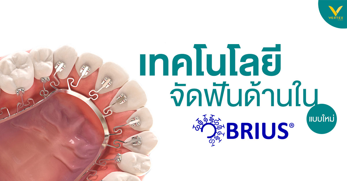 จัดฟันด้านใน Brius