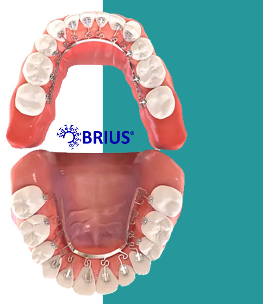 ิBrius