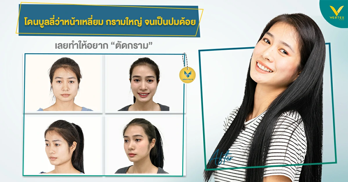 รีวิวตัดกราม