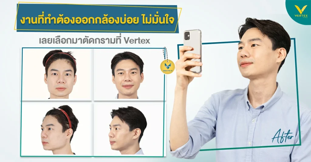 รีวิวตัดกรามคุณพี