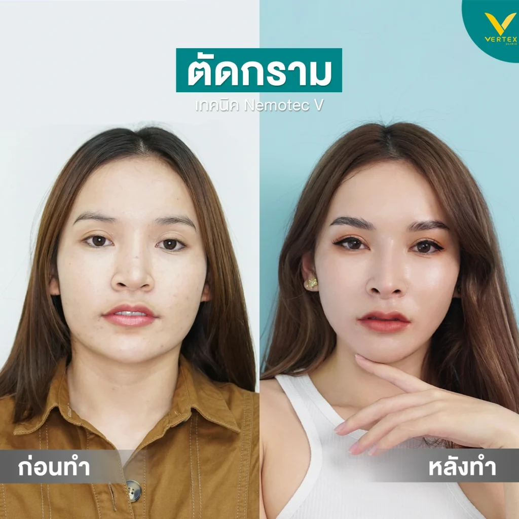 รีวิววีไลน์-คุณน้อยนารี-[กราม]