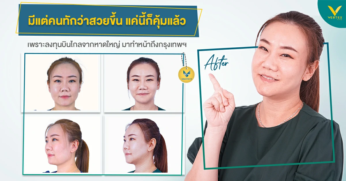 รีวิวตัดกรามคุณนิ้กกี้