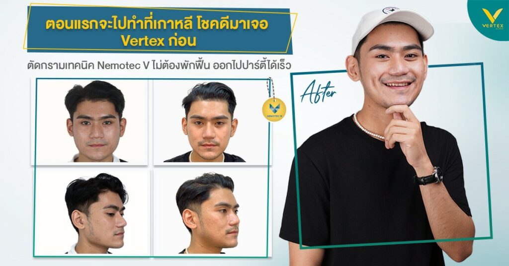 รีวิวตัดกรามคุณเจฟฟี่