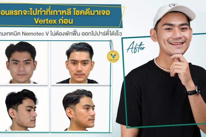 โดนเพื่อนช็อตฟีลตั้งแต่เด็กว่ากรามใหญ่ แค่นั้นไม่พอยังโดนคนที่บ้านช็อตอีก