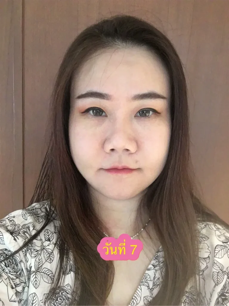 รีวิวตัดกราม
