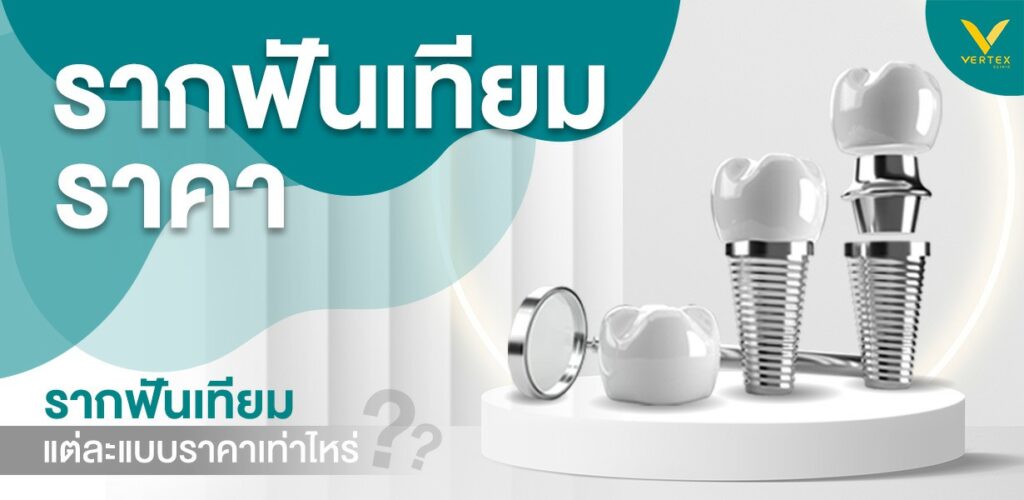รากฟันเทียมราคา