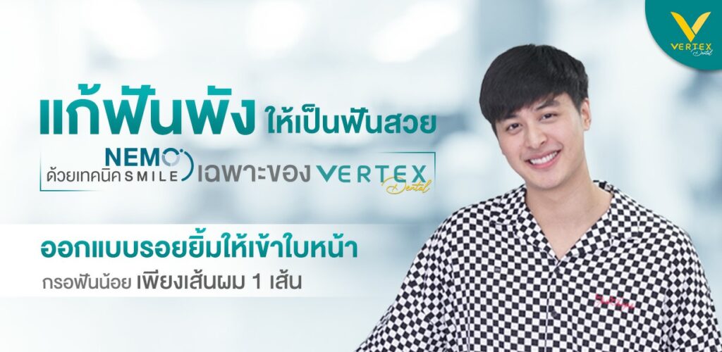 nemo smile วีเนียร์