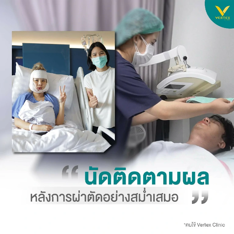 ติดตามผล