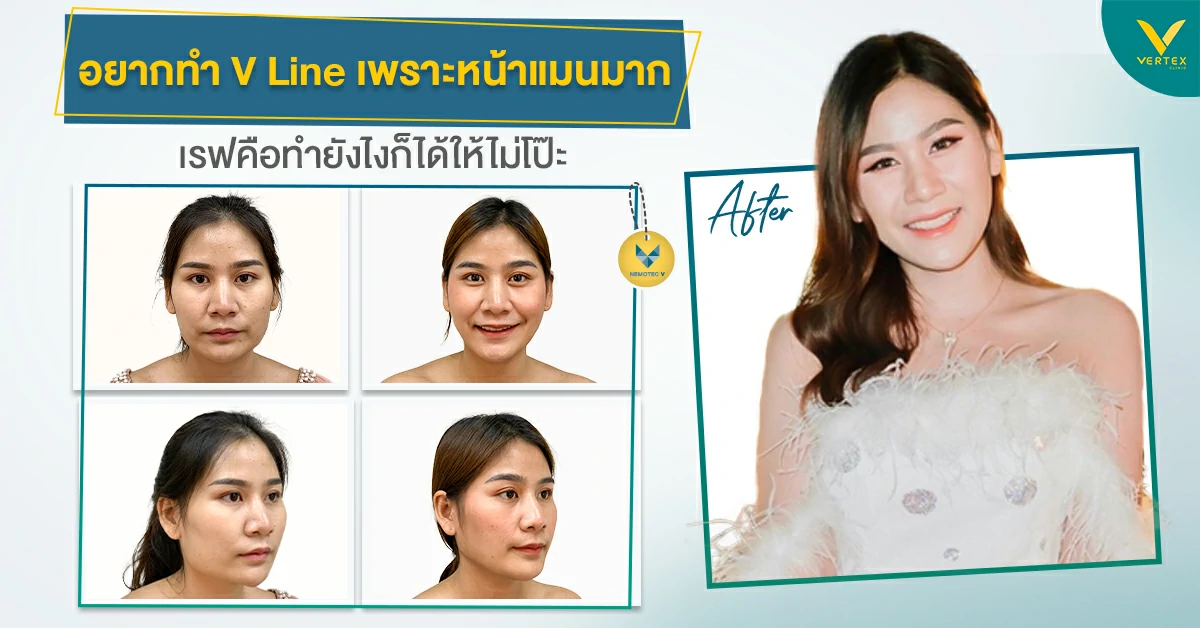 ทําหน้าวีไลน์
