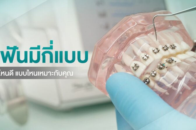 จัดฟันมีกี่แบบ จัดแบบไหนดี แบบไหนเหมาะกับคุณ
