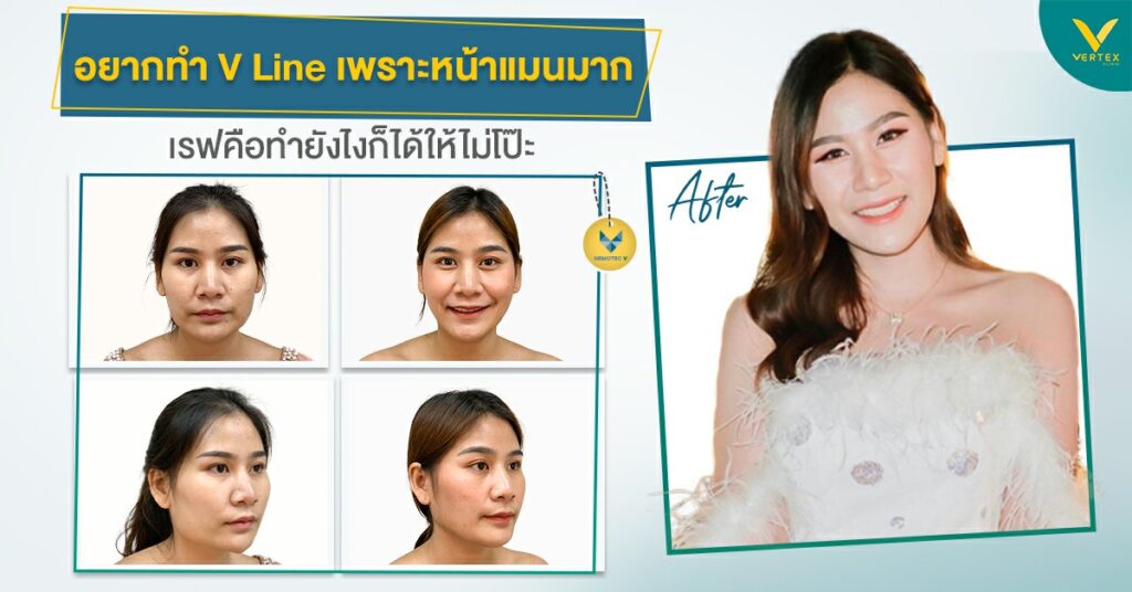 ทําหน้าวีไลน์