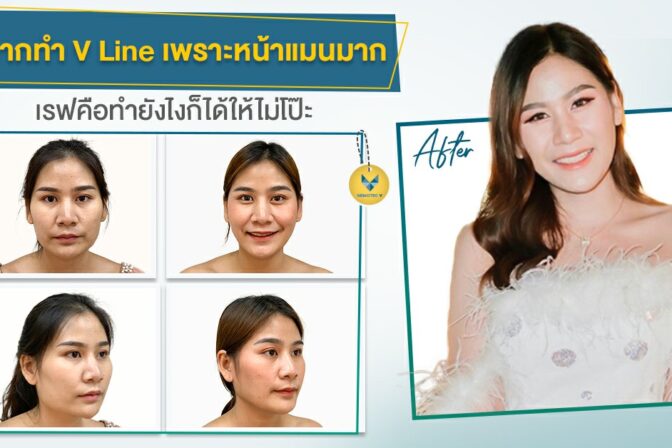 อยากทำ Vline เพราะหน้าแมนมากเรฟคือทำยังไงก็ได้ให้ไม่โป๊ะ