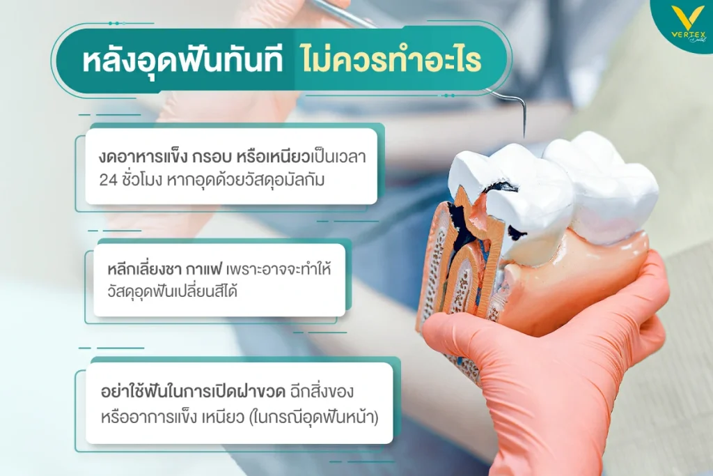 รักษารากฟัน