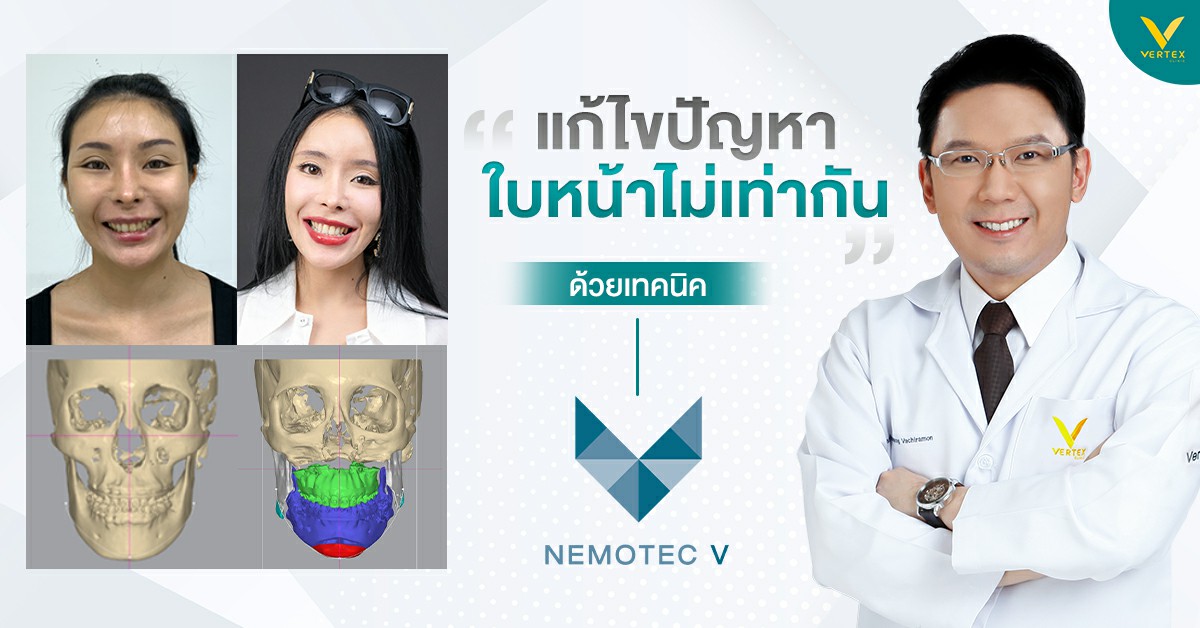 แก้ไขปัญหาใบหน้าไม่เท่ากัน