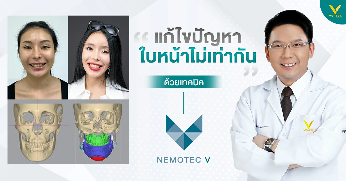 หน้าเบี้ยว
