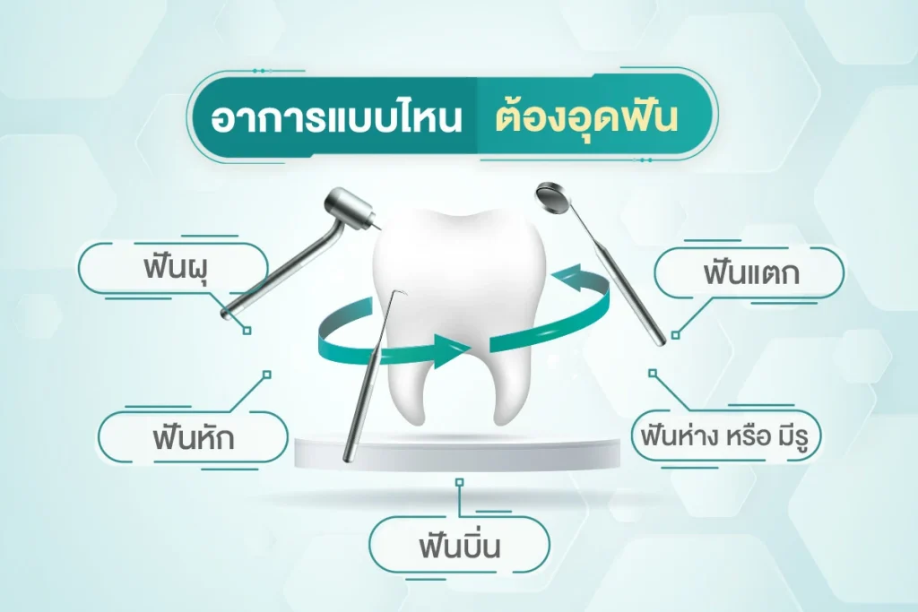 อุดฟันชั่วคราว