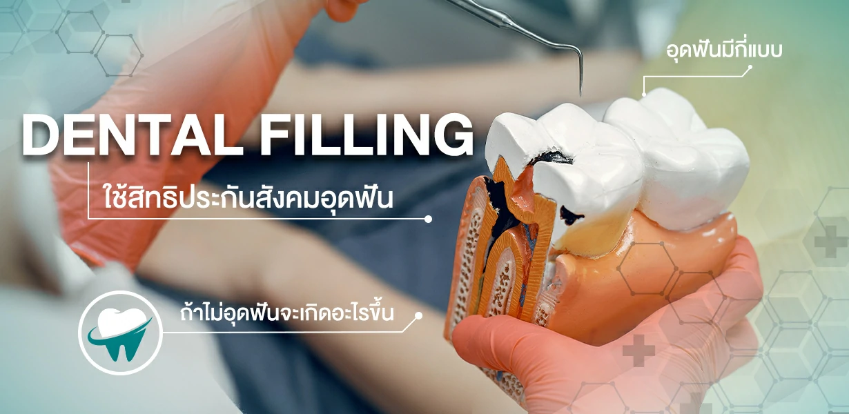 อุดฟันชั่วคราว