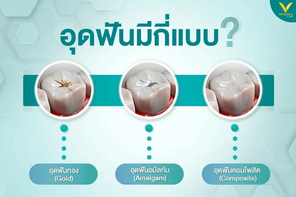 วัสดุอุดฟันชั่วคราว