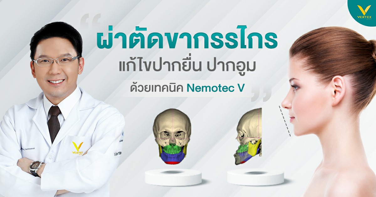 แก้ปากอูมแก้ปากยื่น ฟันเหยินปากอูม โดยการผ่าตัดขากรรไกร