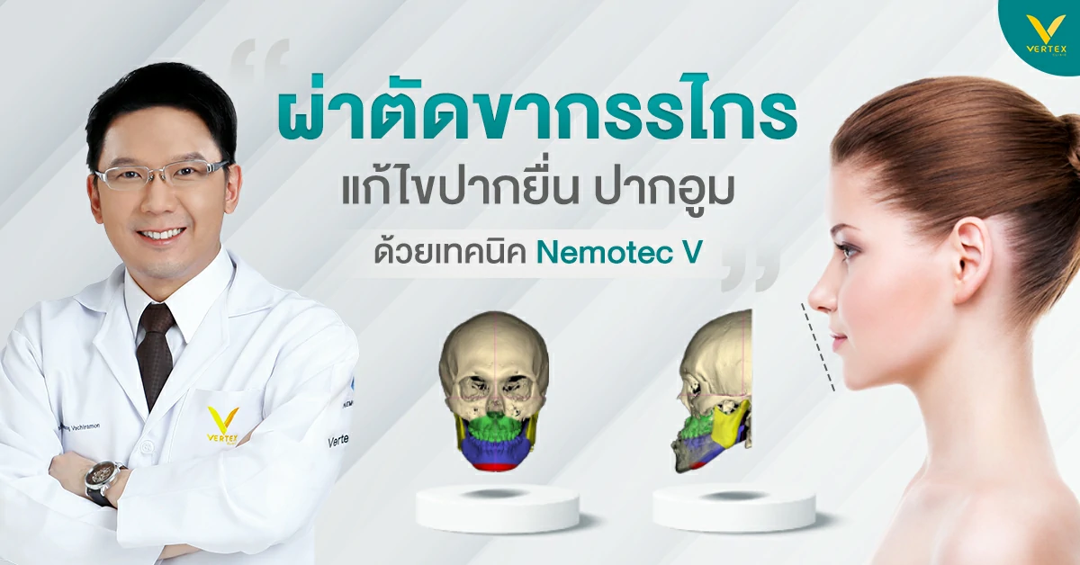 ผ่าตัดขากรรไกรแก้ไขปากอูม