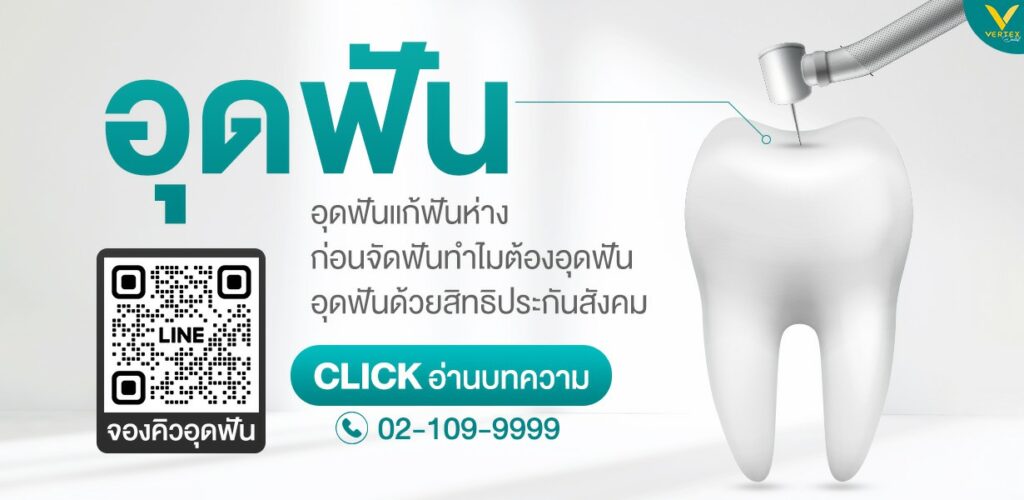 อุดฟันราคา