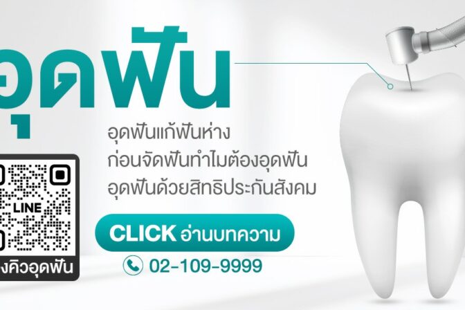 อุดฟันราคาเท่าไหร่ อุดฟันใช้สิทธิประกันสังคมได้ไหม ทำไมก่อนจัดฟันต้องอุดฟัน เคลียร์ช่องปากก่อนจัดฟันราคา