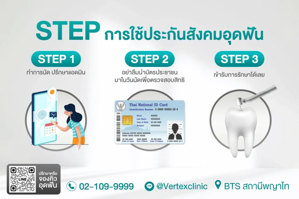 ราคาอุดฟัน
