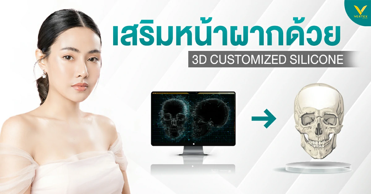 เสริมหน้าผากด้วย 3D Customized Silicone นวัตกรรมความสวย เนียนเป็นธรรมชาติ 