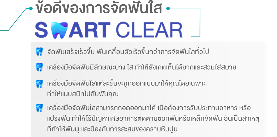 จัดฟันใส SMART CLEAR