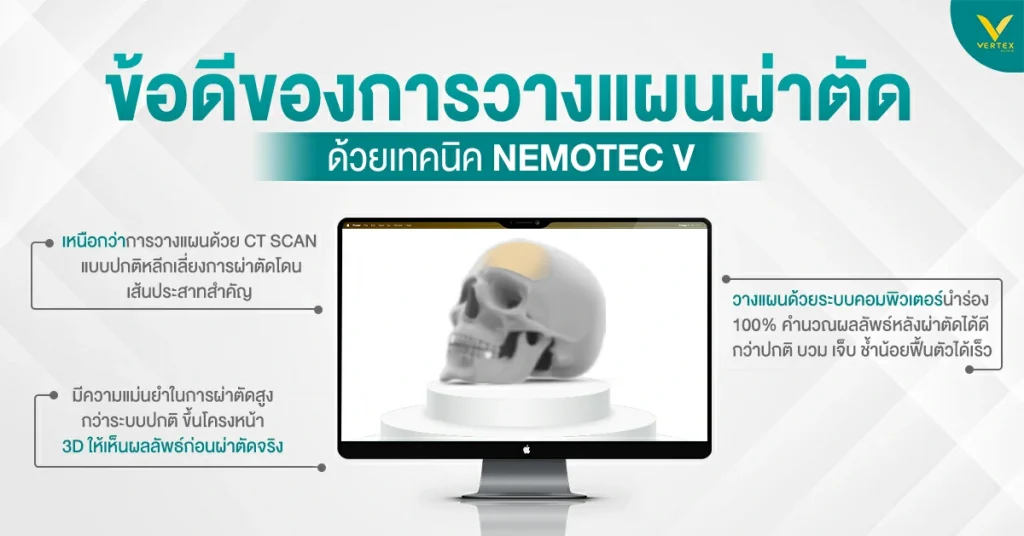 คอมพิวเตอร์นำร่อง 3 มิติ