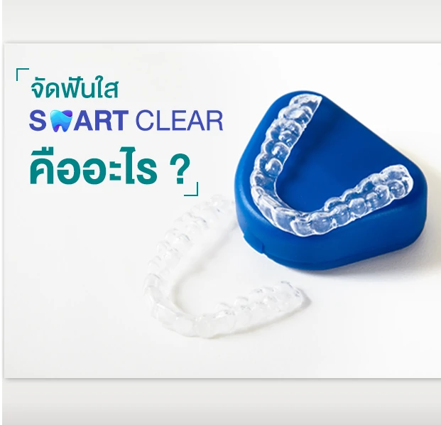 จัดฟันใส SMART CLEAR