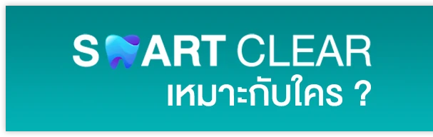 จัดฟันใส SMART CLEAR