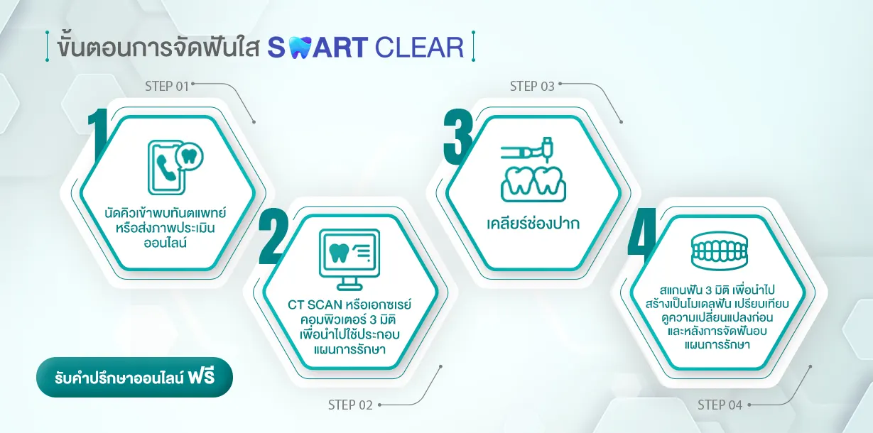 จัดฟันใส SMART CLEAR