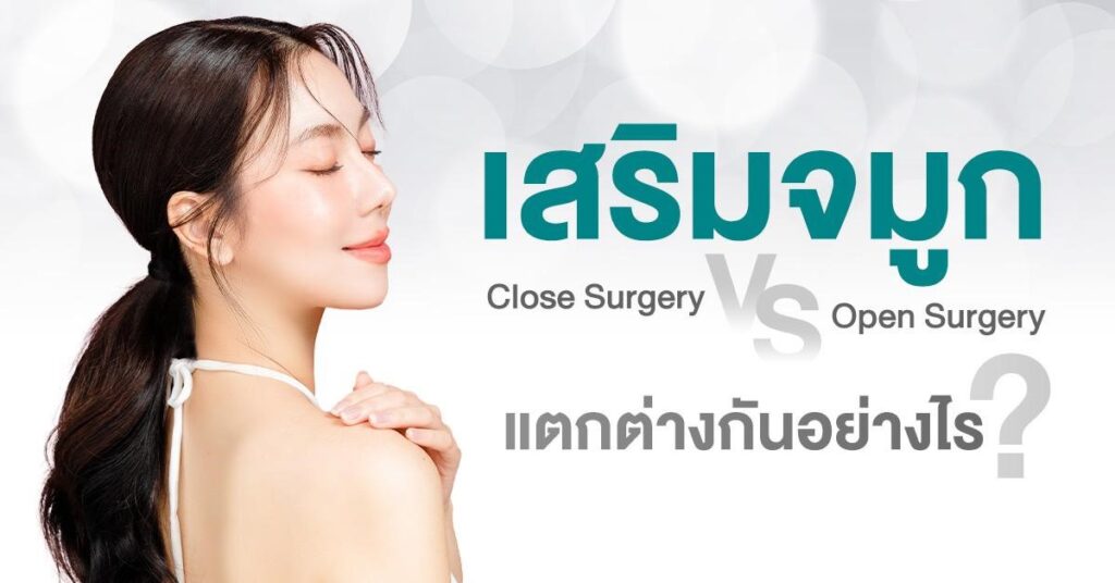 เสริมจมูก