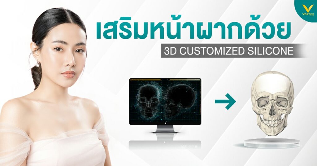เสริมหน้าผากด้วย 3D Customized Silicone นวัตกรรมความสวย เนียนเป็นธรรมชาติ