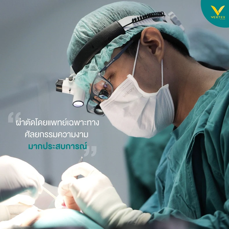 เสริมจมูก vertex 