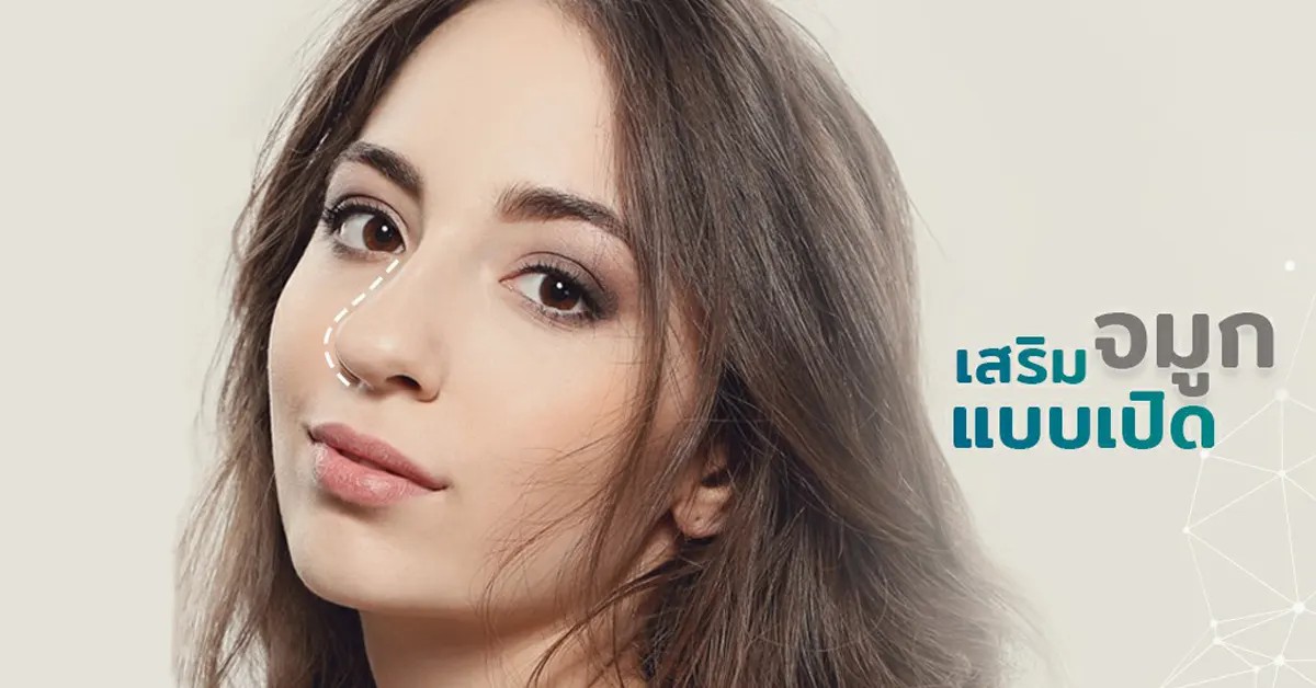 เสริมจมูกเทคนิค Open