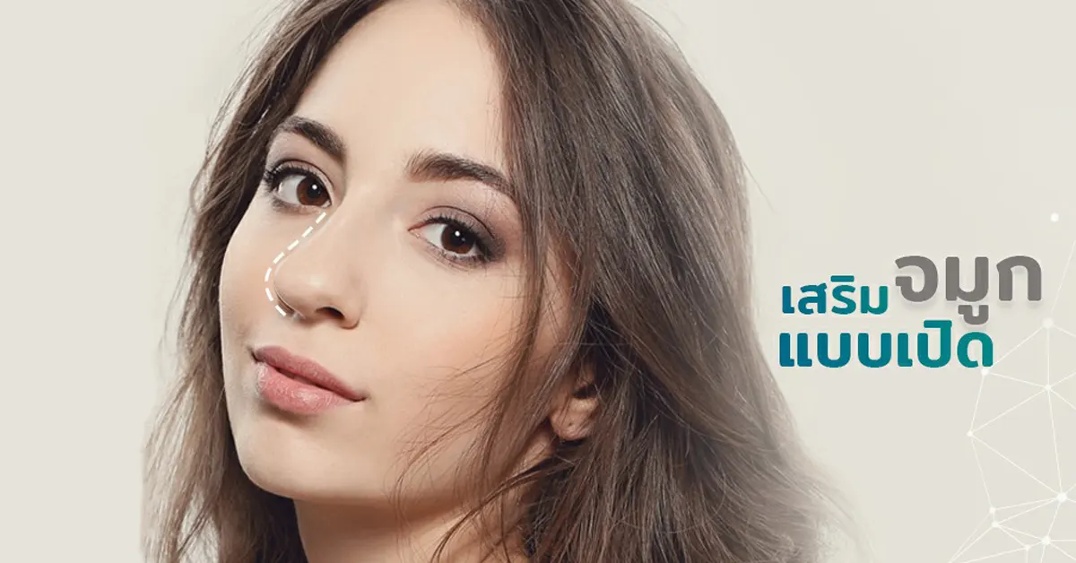 Open-Rhinoplasty