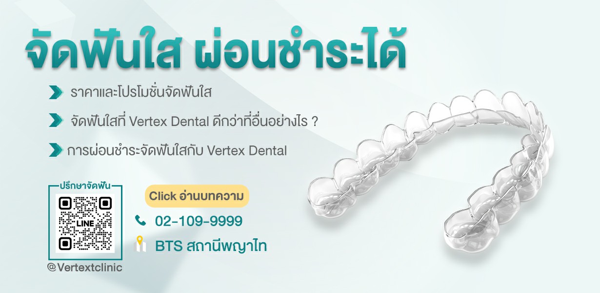 จัดฟันใส ผ่อนชำระได้