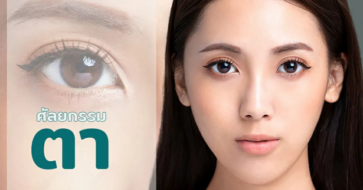 ศัลยกรรมตา