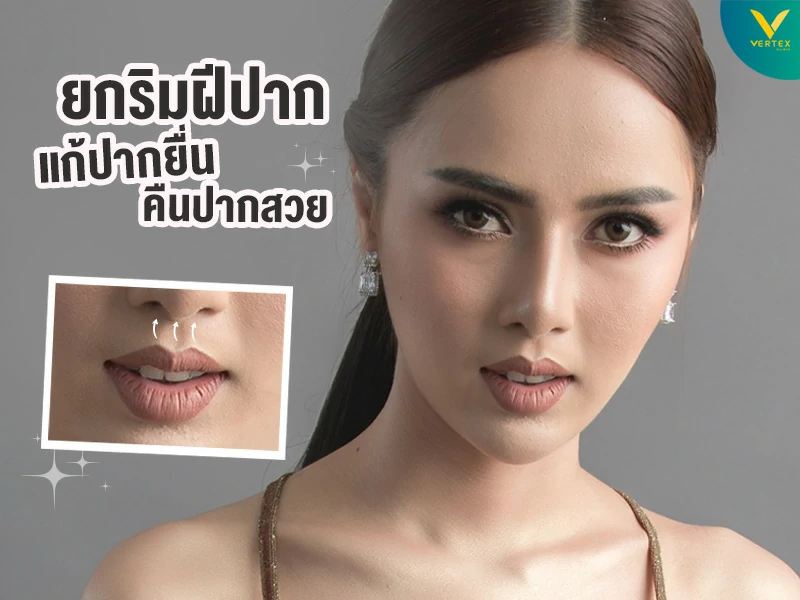ยกริมฝีปากบน