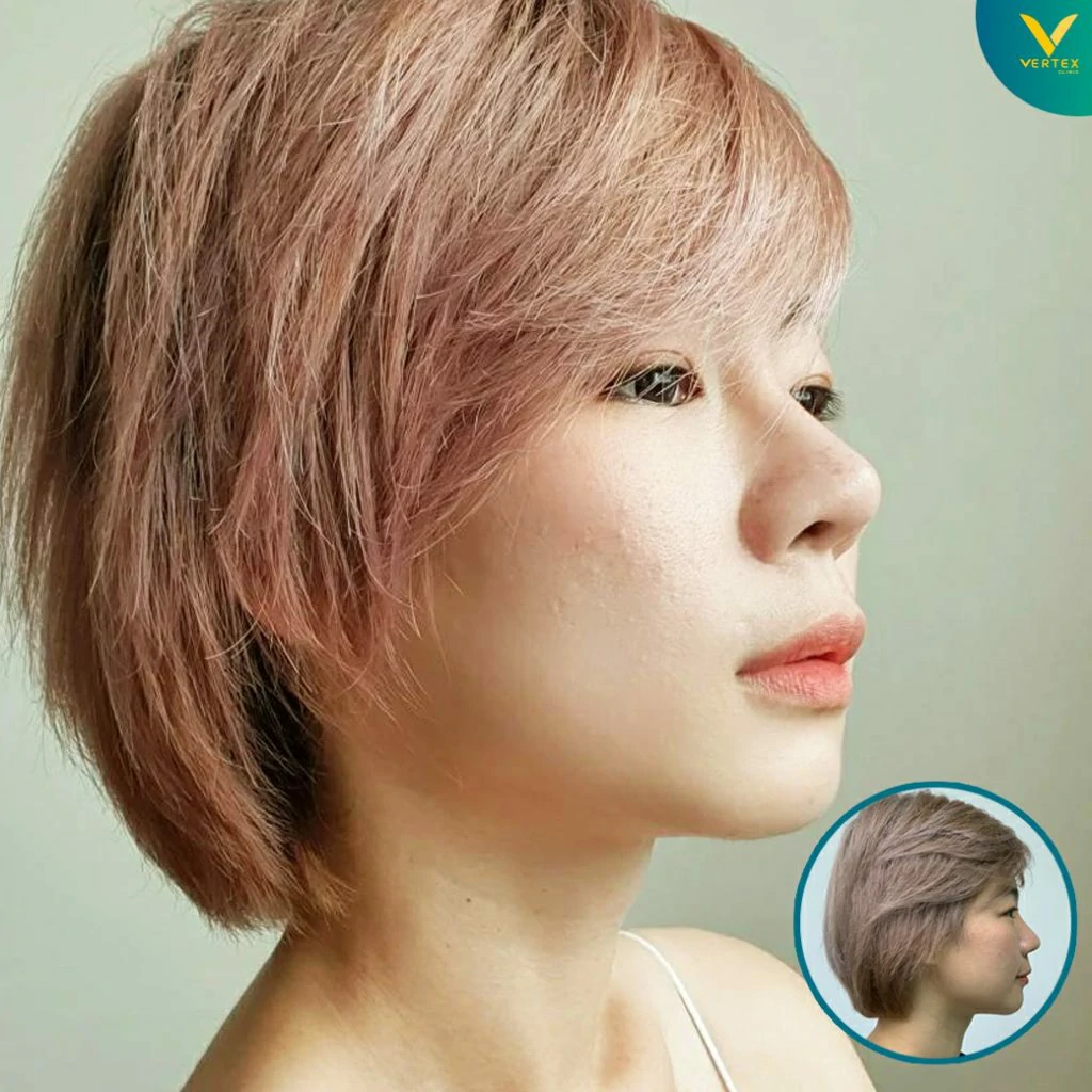 V-Active-Nose