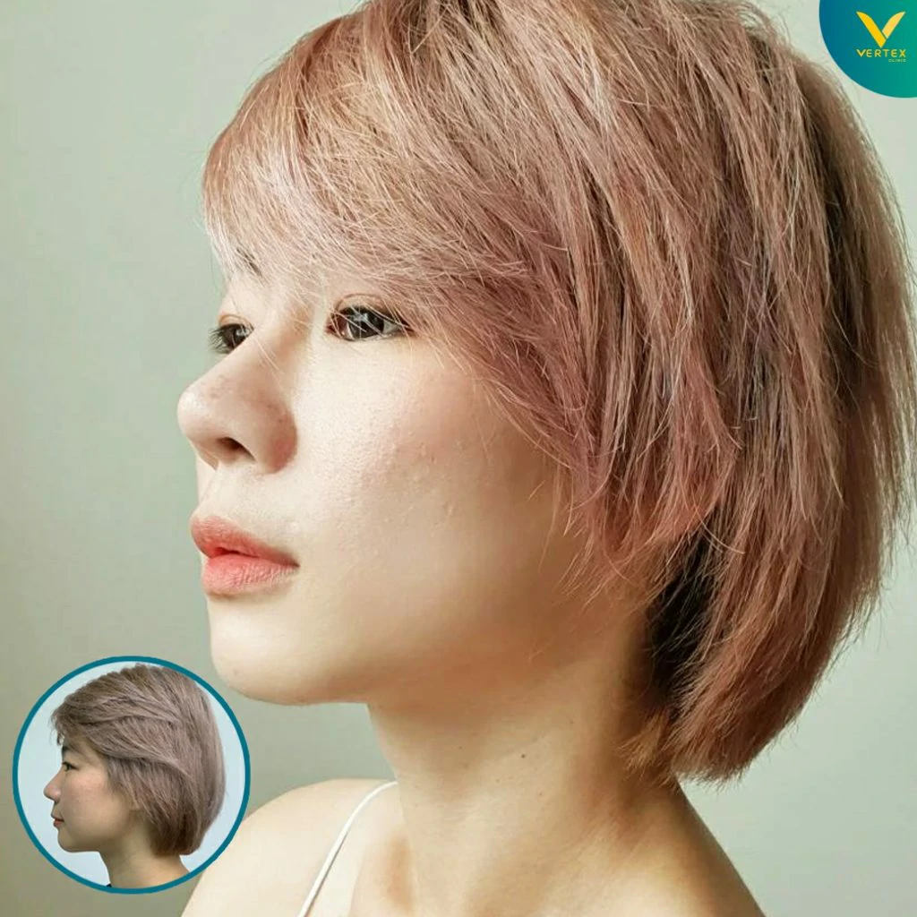 V-Active-Nose