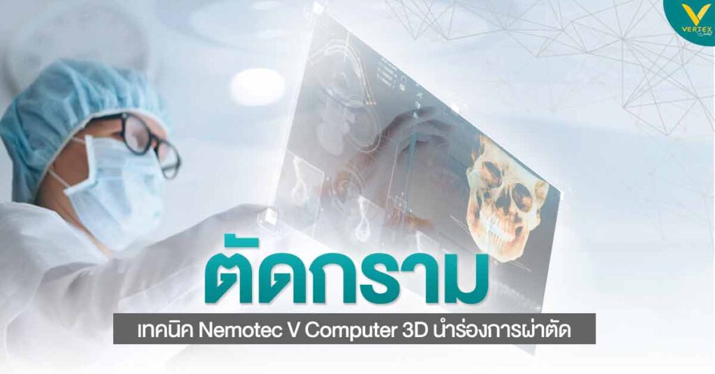 ตัดกราม เทคนิค Nemotec V