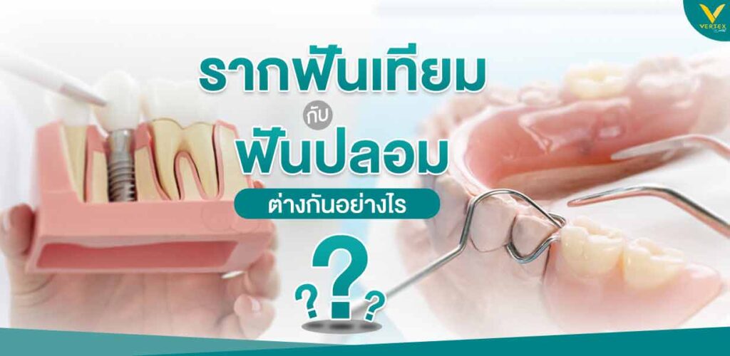 รากฟันเทียม