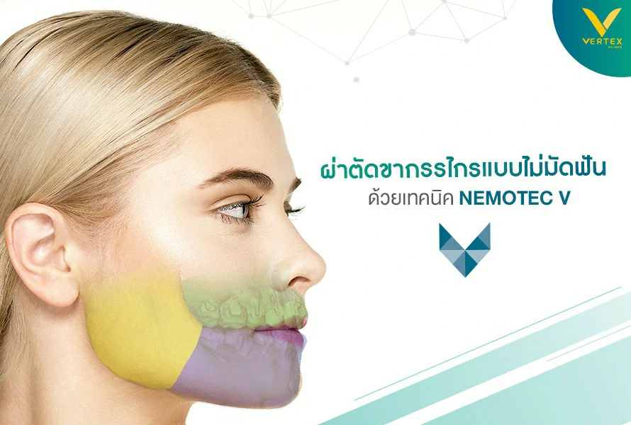 ผ่าขากรรไกรไม่มัดฟัน