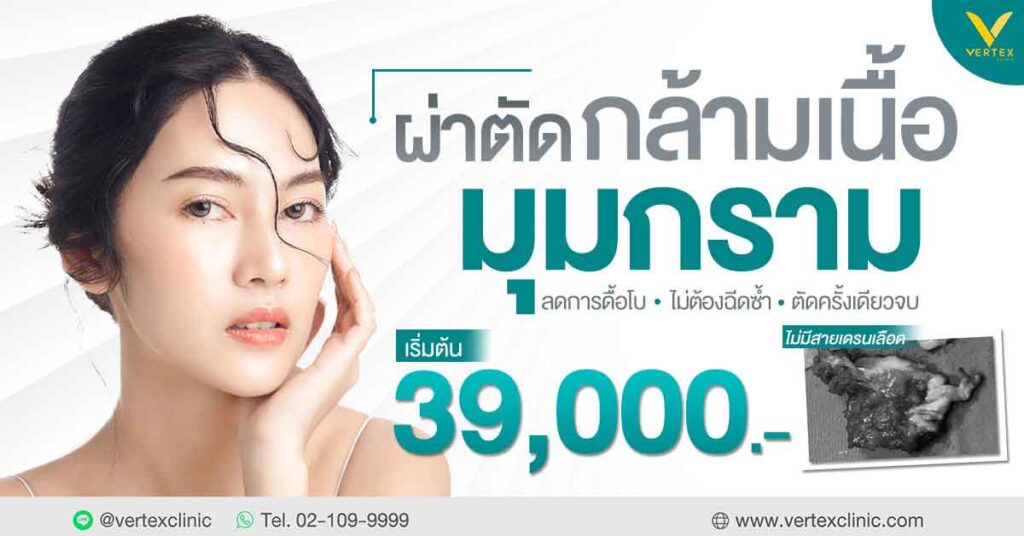 กล้ามเนื้อกราม